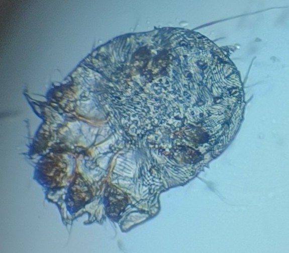 Scabies / Fnat diagnostik