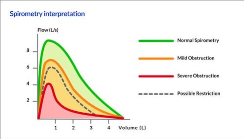 Spirometri - Acceptkriterier